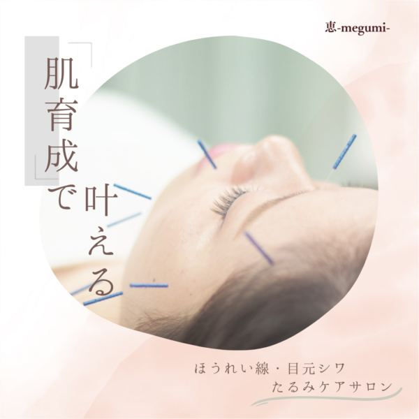 美容鍼サロン「恵-megumi-」で辛い目の奥の疲れをアップデート